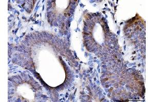 IHC analysis of Cyclin A2 using anti-Cyclin A2 antibody (ABIN3043481).