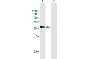 Western Blot analysis of CHRDL2 expression in transfected 293T cell line by CHRDL2 MaxPab polyclonal antibody. (CHRDL2 anticorps  (AA 1-451))