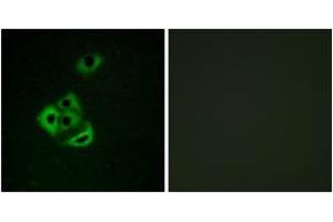 Immunofluorescence analysis of A549 cells, using MCL1 (Phospho-Ser159) Antibody. (MCL-1 anticorps  (pSer159))