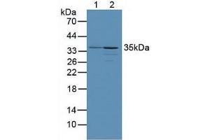 Figure. (PINK1 anticorps  (AA 262-507))
