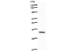 Western Blotting (WB) image for anti-Peroxisome Proliferator-Activated Receptor alpha (PPARA) antibody (ABIN931197)