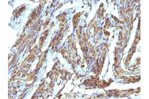 Formalin-fixed, paraffin-embedded human Uterus stained with Calponin Rabbit Polyclonal Antibody
