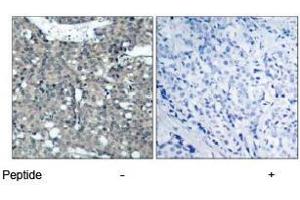 Image no. 1 for anti-Paxillin (PXN) (Tyr118) antibody (ABIN197279) (Paxillin anticorps  (Tyr118))