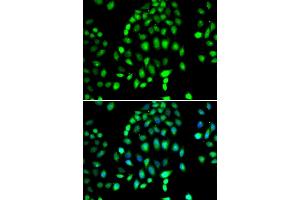 Immunofluorescence analysis of MCF-7 cells using PARP3 antibody (ABIN4904680).