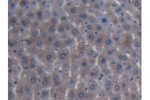 DAB staining on IHC-P; Samples: Mouse Liver Tissue (ITIH4 anticorps  (AA 721-942))