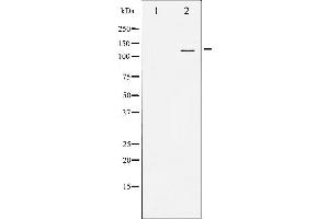Western blot analysis of SREBP-1 expression in TNF treated JK whole cell lysates,The lane on the left is treated with the antigen-specific peptide. (SREBF1 anticorps)
