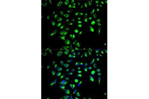 Immunofluorescence analysis of MCF-7 cell using CD86 antibody. (CD86 anticorps  (AA 30-247))