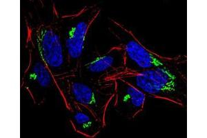 Immunofluorescence analysis of HeLa cells using HDAC4 mouse mAb (green).