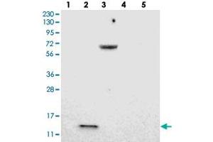 Western blot analysis of Lane 1: RT-4, Lane 2: U-251 MG, Lane 3: Human Plasma, Lane 4: Liver, Lane 5: Tonsil with LOC203547 polyclonal antibody . (VMA21 anticorps)