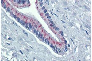 Pancreas, Human: Formalin-Fixed, Paraffin-Embedded (FFPE) (Desmoglein 2 anticorps  (AA 72-121))