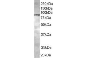 Western Blotting (WB) image for anti-ArfGAP with Coiled-Coil, Ankyrin Repeat and PH Domains 1 (ACAP1) (C-Term) antibody (ABIN2465343) (ACAP1 anticorps  (C-Term))