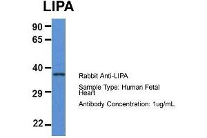 Host: Rabbit  Target Name: LIPA  Sample Tissue: Human Fetal Heart  Antibody Dilution: 1.