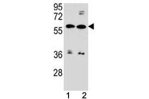 ABCG4 antibody western blot analysis in MDA-MB453, ZR-75-1 lysate.