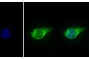 Detection of ALDH1B1 in Human HepG2 cell using Polyclonal Antibody to Aldehyde Dehydrogenase 1 Family, Member B1 (ALDH1B1)