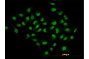 Immunofluorescence of monoclonal antibody to HDAC1 on HeLa cell. (HDAC1 anticorps  (AA 1-482))