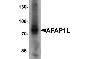 Western blot analysis of AFAP1L1 in A549 cell lysate with AFAP1L1 antibody at 1 µg/mL. (AFAP1L1 anticorps  (N-Term))