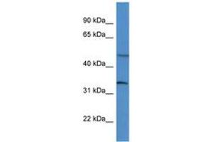 Image no. 1 for anti-Forkhead Box L2 (FOXL2) (AA 154-203) antibody (ABIN6746002) (FOXL2 anticorps  (AA 154-203))
