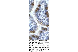 Human Intestine (CDK7 anticorps  (C-Term))