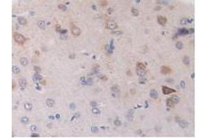 Figure. (DLD anticorps  (AA 238-466))