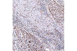 IHC analysis of SMARCA2/BRM using anti-SMARCA2/BRM antibody (ABIN7601969).