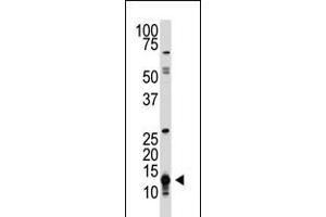 Antibody is used in Western blot to detect SUMO1 in HL-60 cell lysate. (D SUMO (AA 37-66), (C-Term) anticorps)