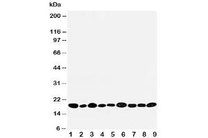 Western blot testing of NME2 antibody and rat samples 1: heart