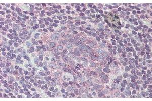 Detection of IL6R in Human Placenta Tissue using Polyclonal Antibody to Interleukin 6 Receptor (IL6R) (IL-6 Receptor anticorps)