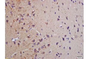 Formalin-fixed and paraffin embedded rat brain labeled with Anti-phospho-MBP(Thr232)Polyclonal Antibody, Unconjugated  at 1:200 followed by conjugation to the secondary antibody and DAB staining (MBP anticorps  (pThr232))