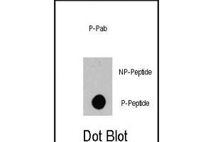 Dot blot analysis of anti-BRAF-p Phospho-specific Pab (ABIN389803 and ABIN2839698) on nitrocellulose membrane. (BRAF anticorps  (pSer445))