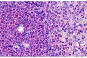 Human Tonsil: Formalin-Fixed, Paraffin-Embedded (FFPE) (CD180 anticorps  (N-Term))