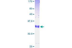 Image no. 1 for Lymphocyte Antigen 6 Complex, Locus H (LY6H) (AA 26-140) protein (GST tag) (ABIN1309906)