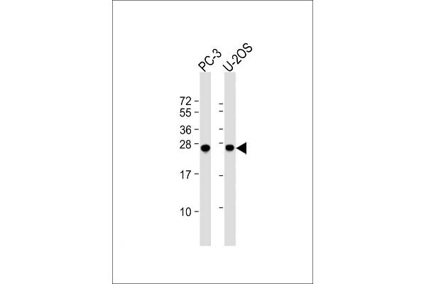 ZCCHC17 anticorps  (AA 159-187)