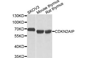 Western blot analysis of extracts of various cell lines, using CDKN2AIP antibody (ABIN5971664) at 1/1000 dilution. (CDKN2AIP anticorps)