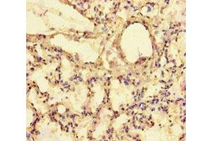 Immunohistochemistry of paraffin-embedded human lung tissue using ABIN7152273 at dilution of 1:100 (Exophilin 5 anticorps  (AA 1235-1490))