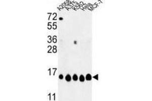 Western Blotting (WB) image for anti-Histone H2A Type 1-H (HIST1H2AH) antibody (ABIN3003926) (HIST1H2AH anticorps)