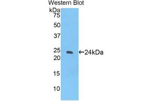 Western blot analysis of the recombinant protein. (SIGLEC12 anticorps  (AA 22-218))