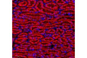 Immunofluorescence of paraffin embedded mouse kidney using MAP7 (ABIN7074621) at dilution of 1:400 (300x lens)