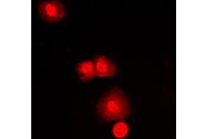 Immunofluorescent analysis of mTOR staining in MCF7 cells. (MTOR anticorps  (C-Term))