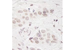 anti-Breast Carcinoma Amplified Sequence 3 (BCAS3) (C-Term) antibody
