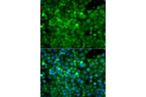 Immunofluorescence analysis of A549 cells using POC1A antibody (ABIN6293867). (POC1A anticorps)