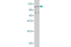 Western Blot detection against Immunogen (89. (Radixin anticorps  (AA 1-583))