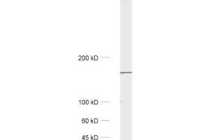 Western Blotting (WB) image for anti-Early Endosome Antigen 1 (EEA1) (AA 2-13) antibody (ABIN1742484)