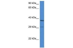 Western Blot showing OGG1 antibody used at a concentration of 1 ug/ml against ACHN Cell Lysate (OGG1 anticorps  (C-Term))