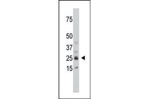 The anti-SULT1C1 Pab (ABIN389131 and ABIN2839309) is used in Western blot to detect SULT1C1 in mouse kidney tissue lysate.