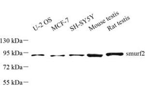 Western blot analysis of smurf2 (ABIN7075626) at dilution of 1: 500 (SMURF2 anticorps)