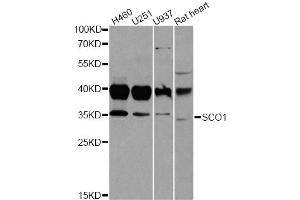Western blot analysis of extracts of various cell lines, using SCO1 antibody. (SCO1 anticorps)