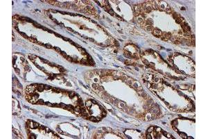 Immunohistochemical staining of paraffin-embedded Human Kidney tissue using anti-PSMB9 mouse monoclonal antibody. (PSMB9 anticorps  (AA 21-219))