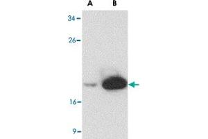 Western blot analysis of (A) 25 and (B) 125 ng of LY96 recombinant protein with LY96 monoclonal antibody, clone 9F1B1  at 1 ug/mL . (LY96 anticorps  (AA 2-160))