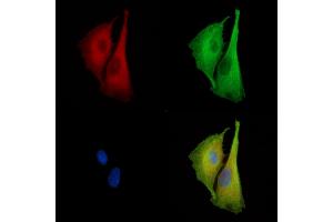 ABIN7096905 and ABIN7100971 staining  cells by IF/ICC. (BRPF3 anticorps)