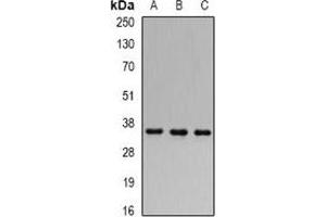 Western blot analysis of FHL-1 expression in 22RV1 (A), MCF7 (B), mouse kidney (C) whole cell lysates. (FHL1 anticorps)